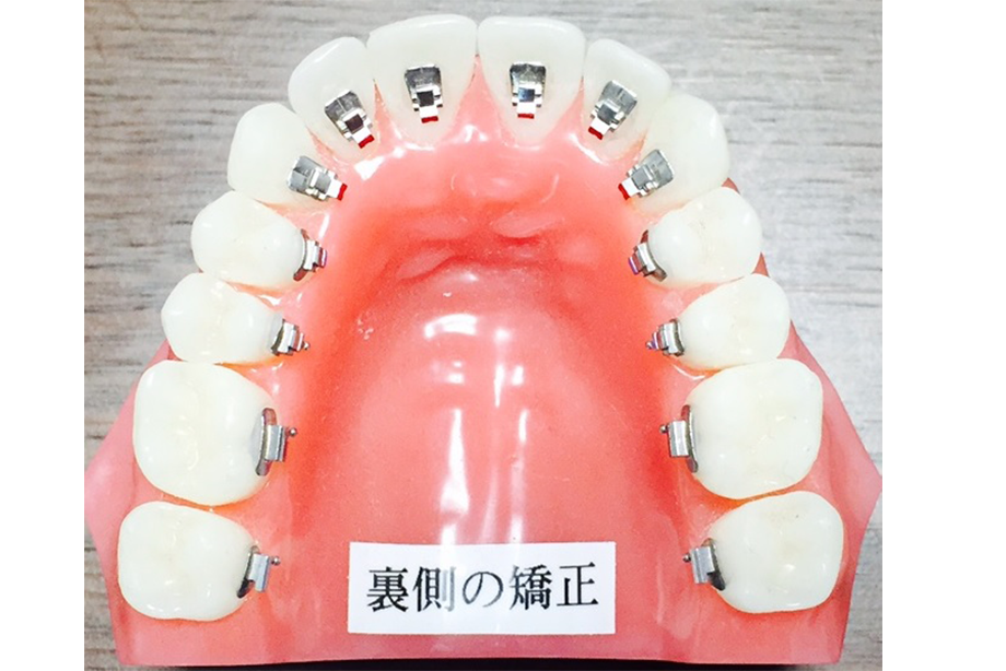 歯磨きが大変になる