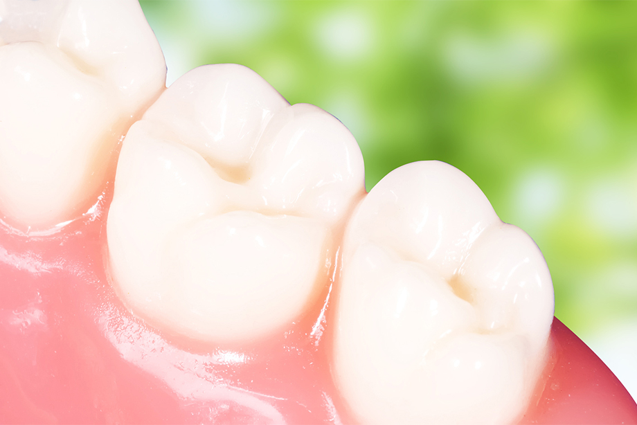 3.できるだけ歯を残す治療